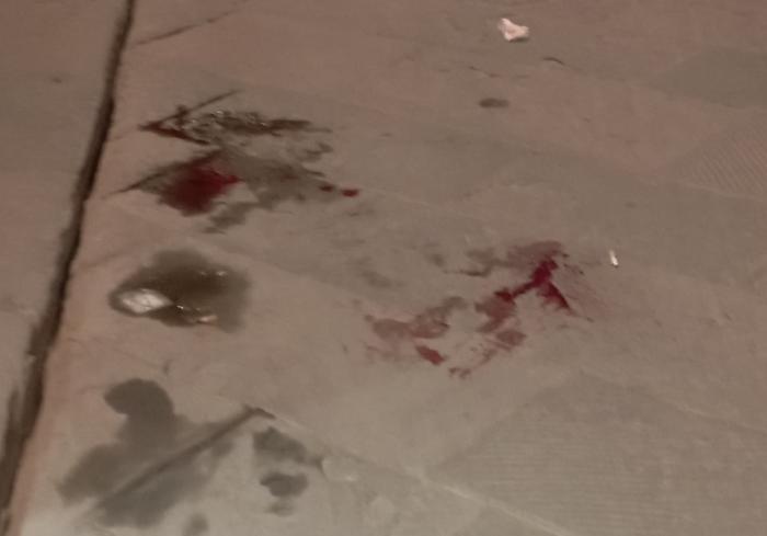 sangue sulle lastre