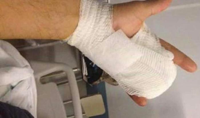 Incidenti botti di capodanno