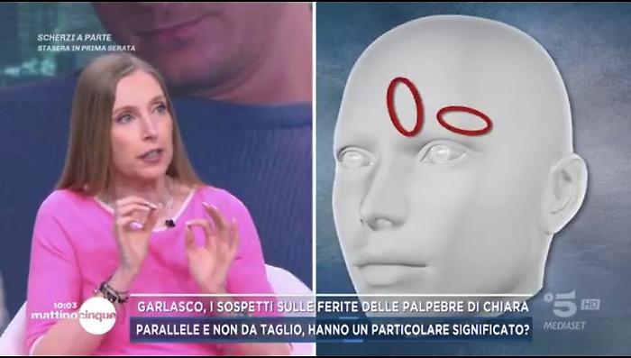 Ferite palpebre Chiara Poggi